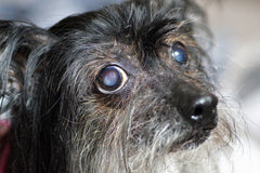 Cloudy Eye Conundrum- Part 2: Lenticular Sclerosis