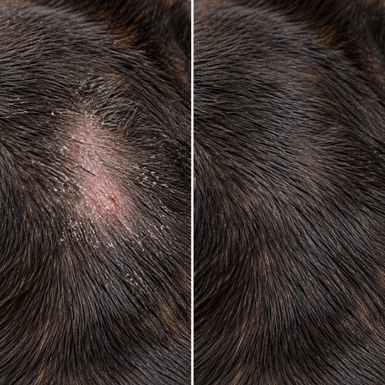 Dry, Flaky-Looking Skin — before and after comparison