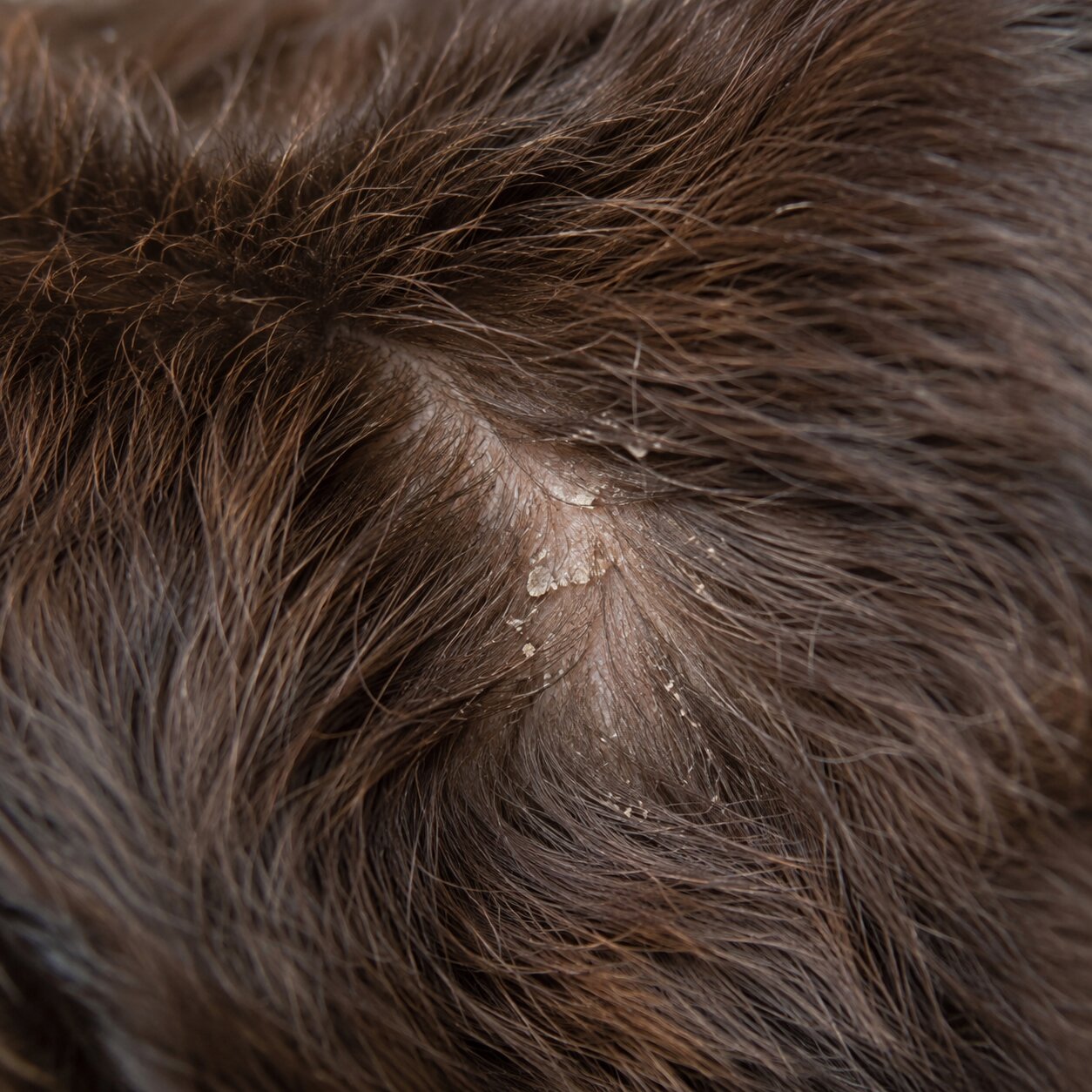 Dry or Flaky-Looking Skin